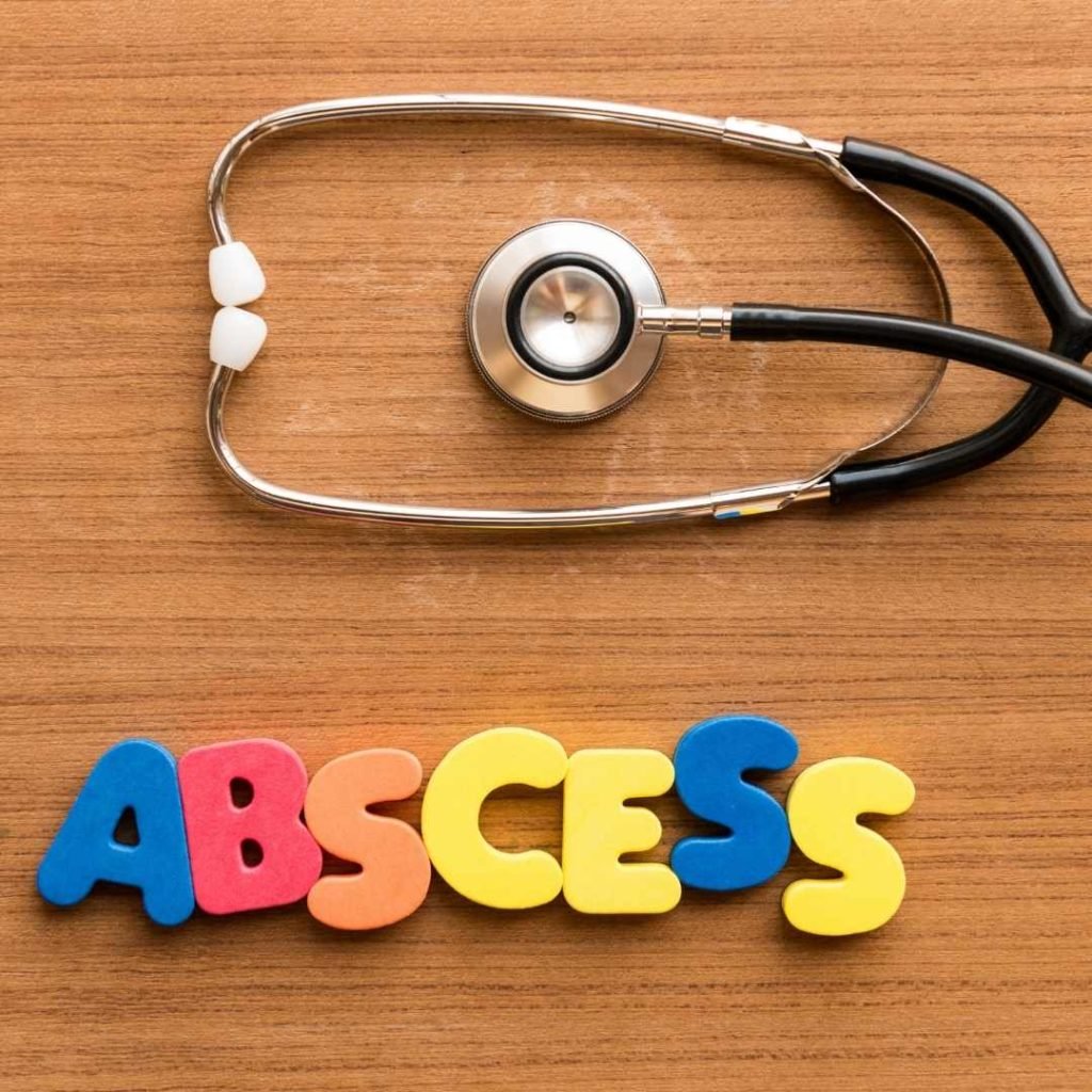 Cat abscess treatment at home Miles with Pets